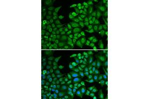 Immunofluorescence analysis of MCF-7 cell using NeuN antibody.