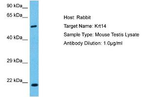Host:  Mouse  Target Name:  KRT14  Sample Tissue:  Mouse Testis  Antibody Dilution:  1ug/ml (KRT14 Antikörper  (C-Term))
