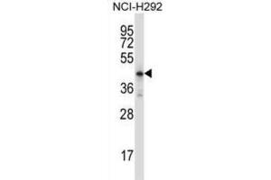 Western Blotting (WB) image for anti-Homeobox D10 (HOXD10) antibody (ABIN2997889) (HOXD10 Antikörper)