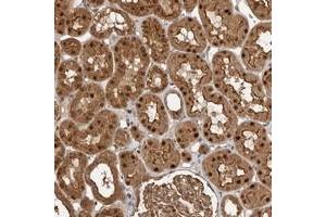 Immunohistochemical staining of human kidney with STRAP polyclonal antibody  shows strong nuclear, cytoplasmic and membranous positivity in cells in tubules at 1:50-1:200 dilution. (STRAP Antikörper)