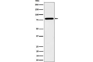 Western Blotting (WB) image for anti-Protein Arginine Methyltransferase 7 (PRMT7) antibody (ABIN7607104)