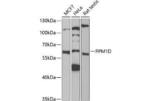 Western blot analysis of extracts of various cell lines, using PPM1D antibody (ABIN6132824, ABIN6146041, ABIN6146042 and ABIN6221792) at 1:1000 dilution. (PPM1D Antikörper  (AA 1-250))