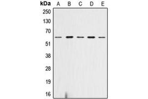 Western blot analysis of AKT (pS473) expression in HeLa (A), SP2/0 (B), mouse heart (C), rat heart (D), rat liver (E) whole cell lysates. (AKT1 Antikörper  (C-Term, pSer473))