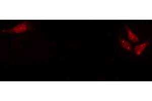 ABIN6272318 staining Hela by IF/ICC. (HEN1/2 Antikörper)