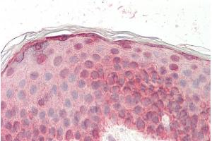 ABIN5539508 (5µg/ml) staining of paraffin embedded Human Skin. (EGF Antikörper  (Internal Region))