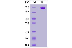 Human NCAM-1, His Tag on  under reducing (R) condition. (CD56 Protein (AA 20-718) (His tag))