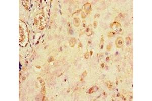 Immunohistochemistry of paraffin-embedded human placenta tissue using ABIN7158587 at dilution of 1:100 (LHB Antikörper  (AA 21-141))