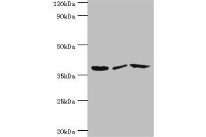 Western blot All lanes: P2RY14 antibody at 12 μg/mL Lane 1: Mouse heart tissue Lane 2: Mouse stomach tissue Lane 3: Mouse small intestine tissue Secondary Goat polyclonal to rabbit IgG at 1/10000 dilution Predicted band size: 39 kDa Observed band size: 39 kDa (P2RY14 Antikörper  (AA 209-338))