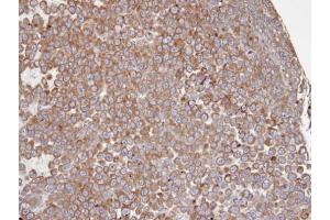 IHC-P Image Immunohistochemical analysis of paraffin-embedded PC13 xenograft, using PTGS1 , antibody at 1:100 dilution. (PTGS1 Antikörper  (C-Term))