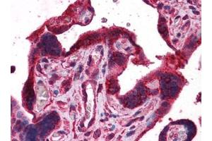 Human Placenta: Formalin-Fixed, Paraffin-Embedded (FFPE) (DPP8 Antikörper)