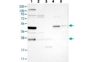 Western blot analysis of Lane 1: RT-4, Lane 2: U-251 MG, Lane 3: Human Plasma, Lane 4: Liver, Lane 5: Tonsil with SMAP2 polyclonal antibody . (SMAP2 Antikörper)