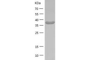 Western Blotting (WB) image for GDP-Mannose 4,6-Dehydratase (GMDS) (AA 1-372) protein (His tag) (ABIN7123070) (GMDS Protein (AA 1-372) (His tag))