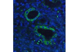 IF analysis of Hexokinase 1/HK1 using anti-Hexokinase 1/HK1 antibody (ABIN7600259). (Hexokinase 1 Antikörper  (AA 17-323))