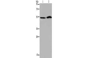 Gel: 8 % SDS-PAGE, Lysate: 40 μg, Lane 1-2: Hela cells, 293T cells, Primary antibody: ABIN7192423(SLC22A12 Antibody) at dilution 1/200, Secondary antibody: Goat anti rabbit IgG at 1/8000 dilution, Exposure time: 40 seconds (SLC22A12 Antikörper)
