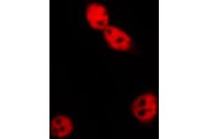 ABIN6269196 staining MCF7 by IF/ICC. (Cyclin E1 Antikörper  (C-Term))