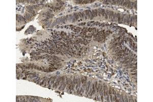 IHC analysis of FOXP1 using anti-FOXP1 antibody (ABIN7602780). (FOXP1 Antikörper  (C-Term))