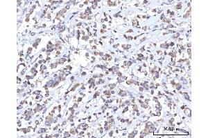 IHC analysis of C18orf22/RBFA using anti-C18orf22/RBFA antibody (ABIN7600106). (RBFA Antikörper  (AA 15-319))