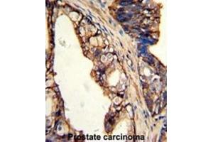 Immunohistochemistry (IHC) image for anti-Transglutaminase 4 (Prostate) (TGM4) antibody (ABIN3002879) (TGM4 Antikörper)
