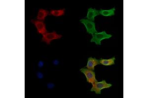 ABIN6257487 and ABIN6275419 staining Hela cells by IF/ICC.