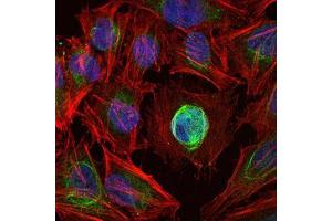 Immunofluorescence (IF) image for anti-Matrix Metallopeptidase 1 (Interstitial Collagenase) (MMP1) antibody (ABIN969287)