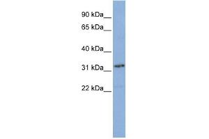 Western Blotting (WB) image for anti-Small Nuclear RNA Activating Complex, Polypeptide 2, 45kDa (SNAPC2) (N-Term) antibody (ABIN2777253)