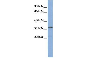 WB Suggested Anti-SNAPC2 Antibody Titration: 0. (SNAPC2 Antikörper  (N-Term))