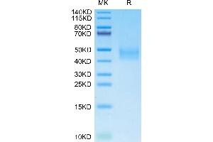 SDS-PAGE (SDS) image for delta-Like 1 Homolog (Drosophila) (DLK1) (AA 24-306) protein (His tag) (ABIN7274476)