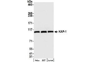 Western Blotting (WB) image for anti-Tripartite Motif Containing 28 (TRIM28) (AA 1-50) antibody (ABIN7455078)
