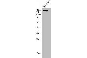 Western Blot analysis of SH-SY5Y cells using CLASP1 Polyclonal Antibody (CLASP1 Antikörper  (C-Term))