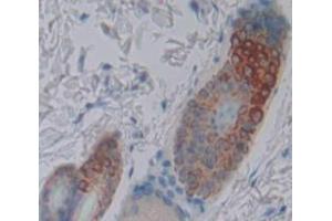 IHC-P analysis of Mouse Tissue, with DAB staining. (LDLRAP1 Antikörper  (AA 1-308))