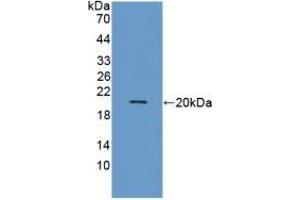 Detection of Recombinant MMP9, Human using Monoclonal Antibody to Matrix Metalloproteinase 9 (MMP9)