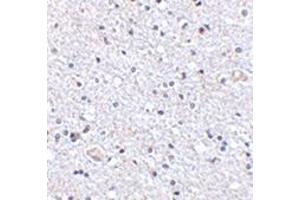 Immunohistochemistry of TSLP in human brain tissue with this product at 2. (Thymic Stromal Lymphopoietin Antikörper  (Center))
