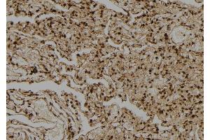 ABIN6274039 at 1/100 staining Human lung tissue by IHC-P. (PPP1CA + 1CB Antikörper)