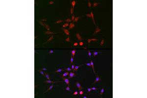 Immunofluorescence analysis of BALB-3T3 cells using LOX Rabbit pAb (ABIN6133805, ABIN6143288, ABIN6143289 and ABIN6223629) at dilution of 1:100 (40x lens). (LOX Antikörper)