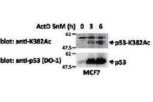 Western Blotting (WB) image for anti-Tumor Protein P53 (TP53) (acLys382) antibody (ABIN3201008) (p53 Antikörper  (acLys382))