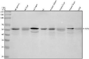 Western blot analysis of Phospho-RIP3 (S232) using anti-Phospho-RIP3 (S232) antibody (ABIN7603289).