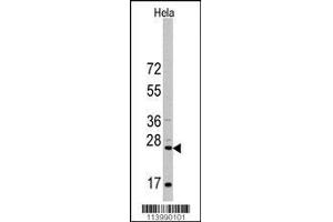Western blot analysis of anti-CD8A Antibody in Hela cell line lysates (35ug/lane)