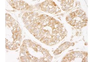 Immunohistochemistry (IHC) image for anti-Lysyl-tRNA Synthetase (KARS) (C-Term) antibody (ABIN7448981) (KARS Antikörper  (C-Term))