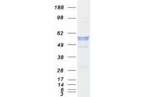 Western Blotting (WB) image for Cytochrome P450, Family 17, Subfamily A, Polypeptide 1 (CYP17A1) protein (Myc-DYKDDDDK Tag) (ABIN2712752)