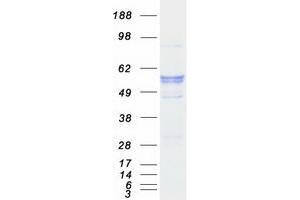 Validation with Western Blot (CYP17A1 Protein (Myc-DYKDDDDK Tag))