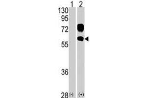 Western blot analysis of KREMEN1 (arrow) using KREMEN1 polyclonal antibody .