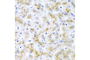 Immunohistochemistry of paraffin-embedded human liver damage using WNT2 antibody (ABIN6130801, ABIN6150239, ABIN6150241 and ABIN6221571) at dilution of 1:200 (40x lens). (WNT2 Antikörper  (AA 26-360))