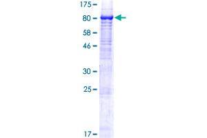 Image no. 1 for Chromosome 1 Open Reading Frame 84 (C1orf84) (AA 1-579) protein (GST tag) (ABIN1308575) (Chromosome 1 Open Reading Frame 84 (C1orf84) (AA 1-579) protein (GST tag))