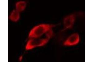 ABIN6275107 staining MCF7 cells by IF/ICC. (ELOVL5 Antikörper  (C-Term))
