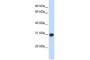 WB Suggested Anti-ZMYND19 Antibody Titration:  0. (ZMYND19 Antikörper  (Middle Region))
