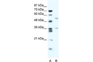 WB Suggested Anti-BTBD3 Antibody Titration:  2. (BTBD3 Antikörper  (Middle Region))