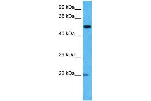 Western Blotting (WB) image for anti-Methyl CpG Binding Protein 2 (MECP2) (N-Term) antibody (ABIN2777533)