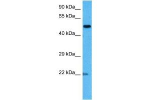 Host:  Mouse  Target Name:  MECP2  Sample Tissue:  Mouse Brain  Antibody Dilution:  1ug/ml (MECP2 Antikörper  (N-Term))