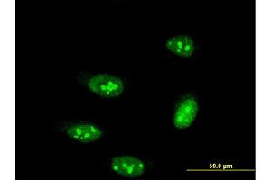Immunofluorescence of monoclonal antibody to TP53RK on HeLa cell. (TP53RK Antikörper  (AA 154-253))
