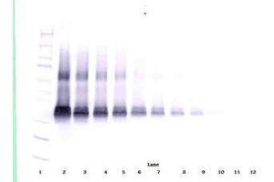Image no. 1 for anti-Vascular Endothelial Growth Factor A (VEGFA) antibody (ABIN465335)